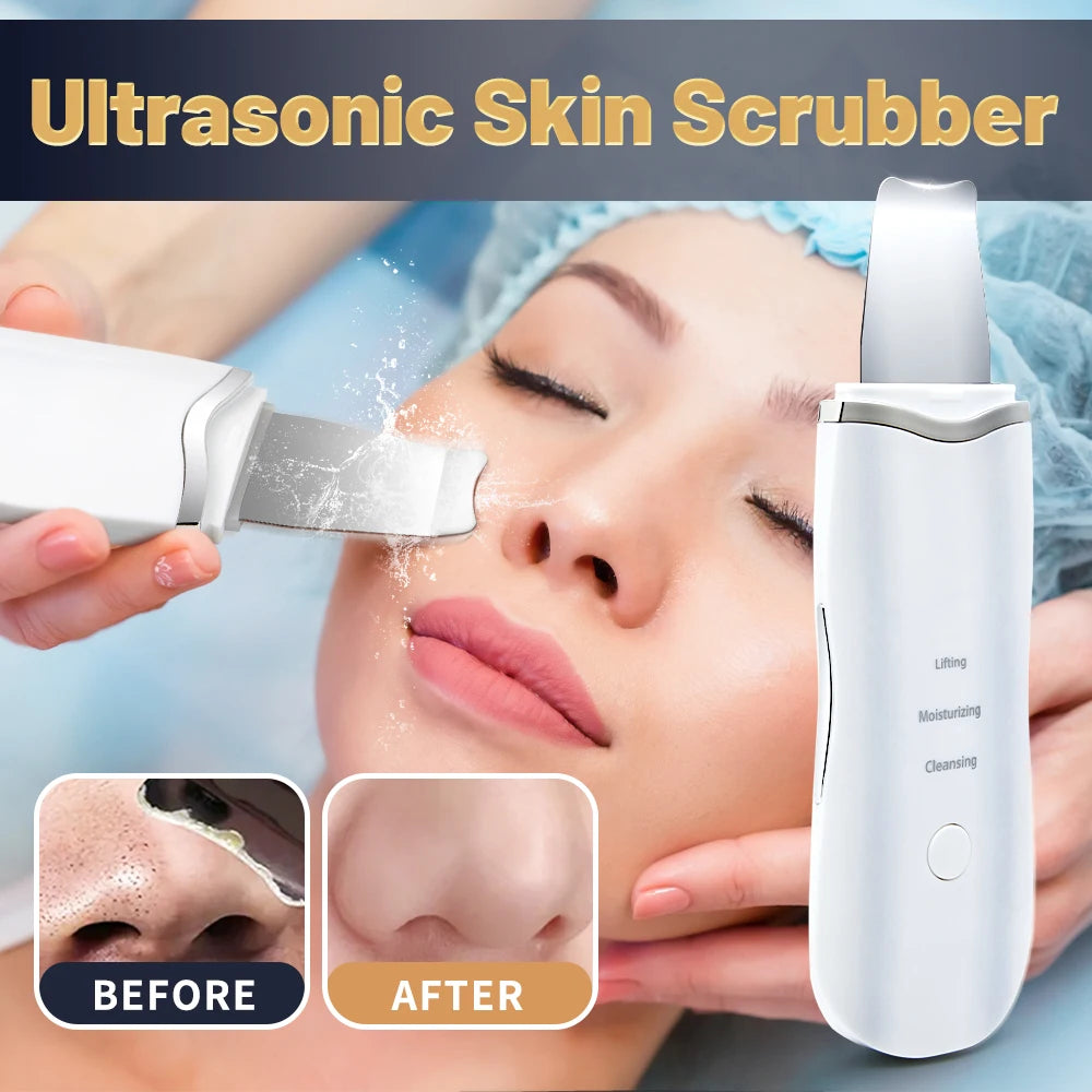 Limpiador Facial Ultrasónico